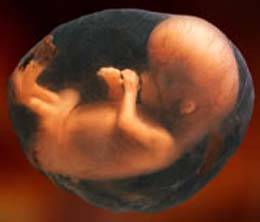 Le jeûne me portera-t-il préjudice pendant la grossesse?