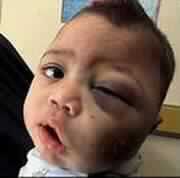 اليورانيوم المنضب والحرب على الفلسطينيين